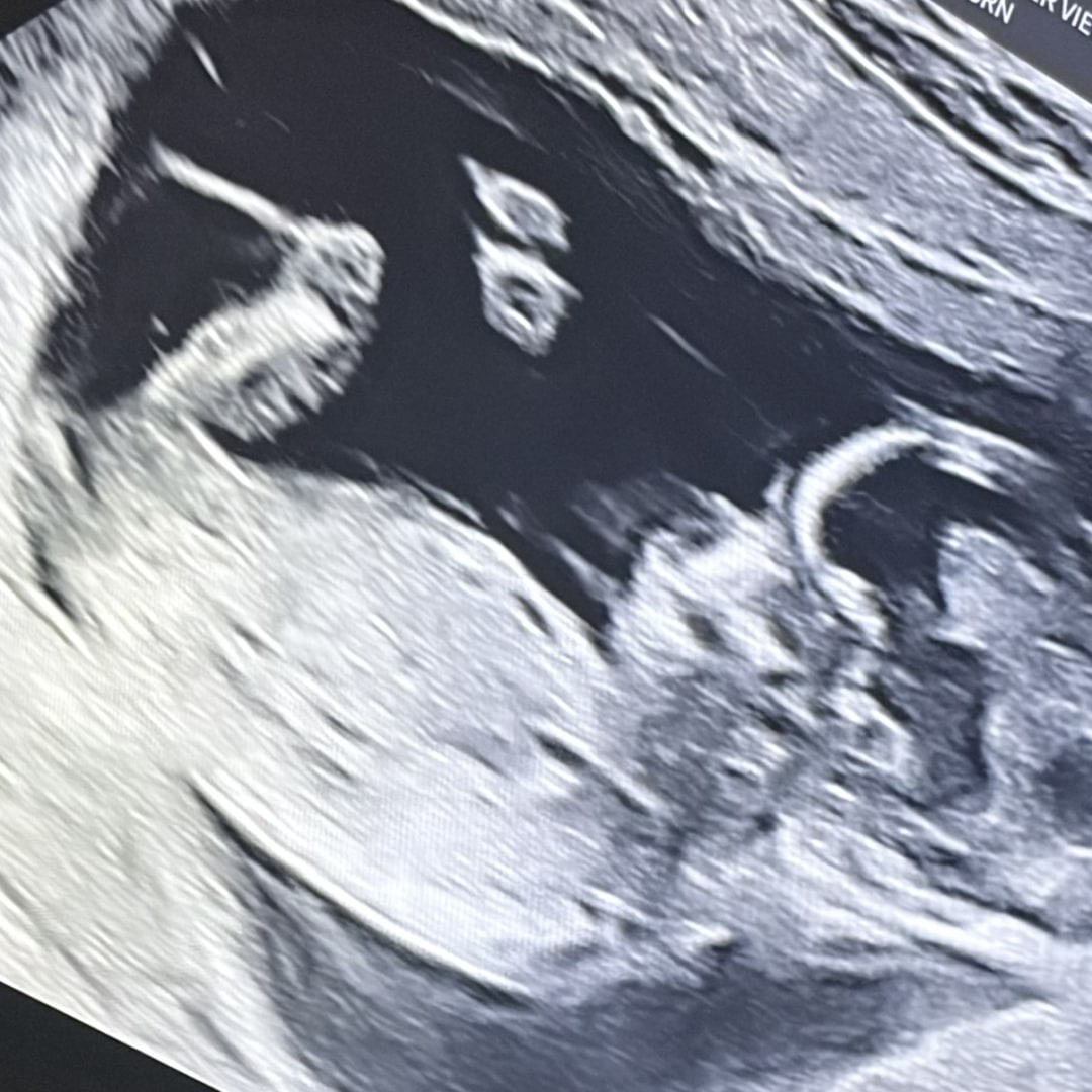Photo shared by Mycalia for their Babylist baby registry.