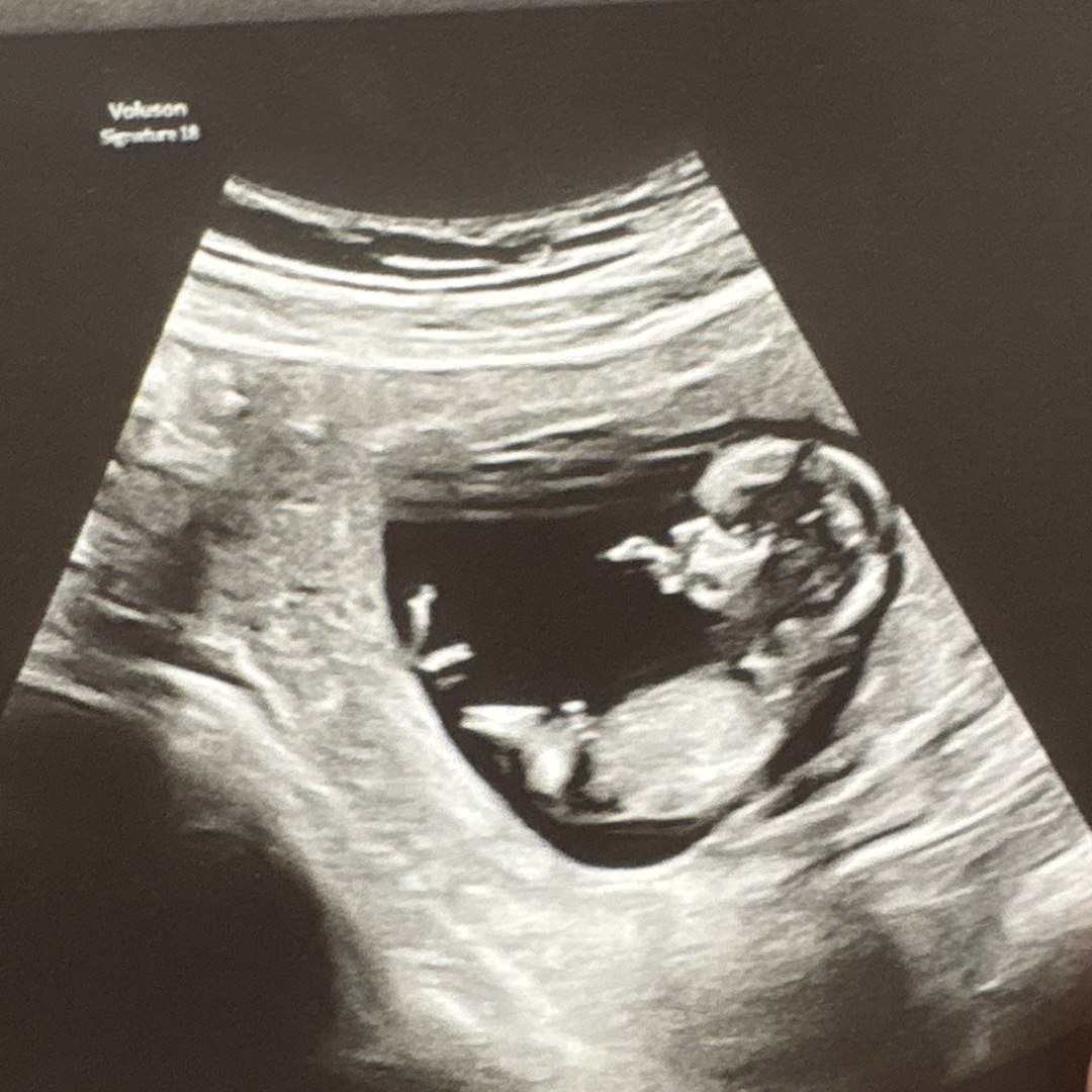 Photo shared by Heather for their Babylist baby registry.