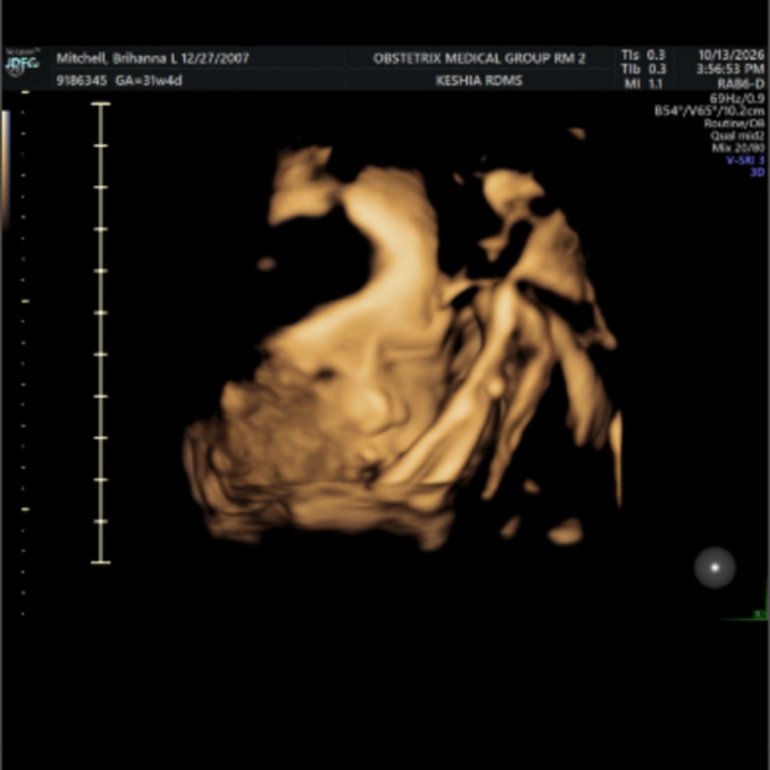 Photo shared by Brihanna for their Babylist baby registry.