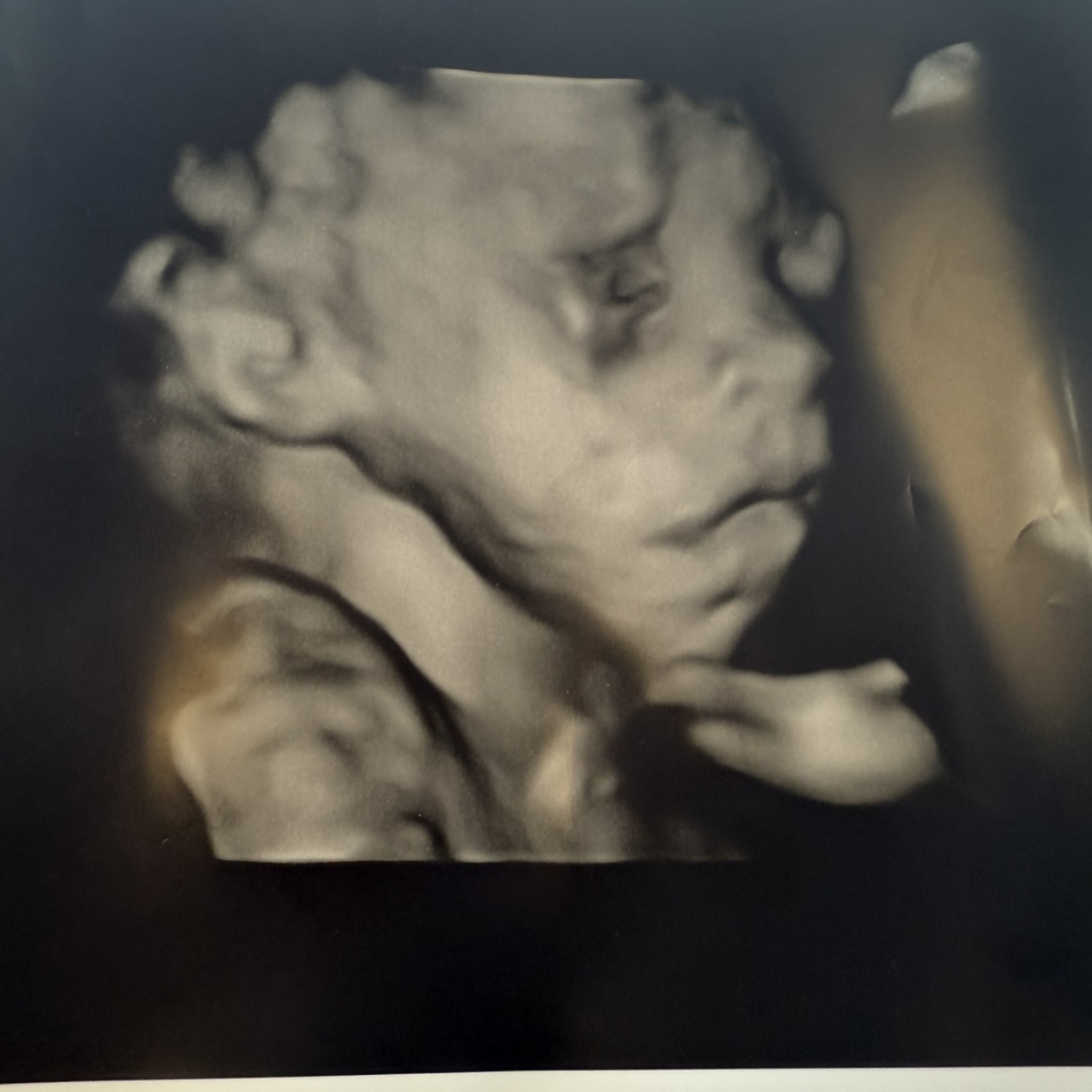 Photo shared by Kattie for their Babylist baby registry.