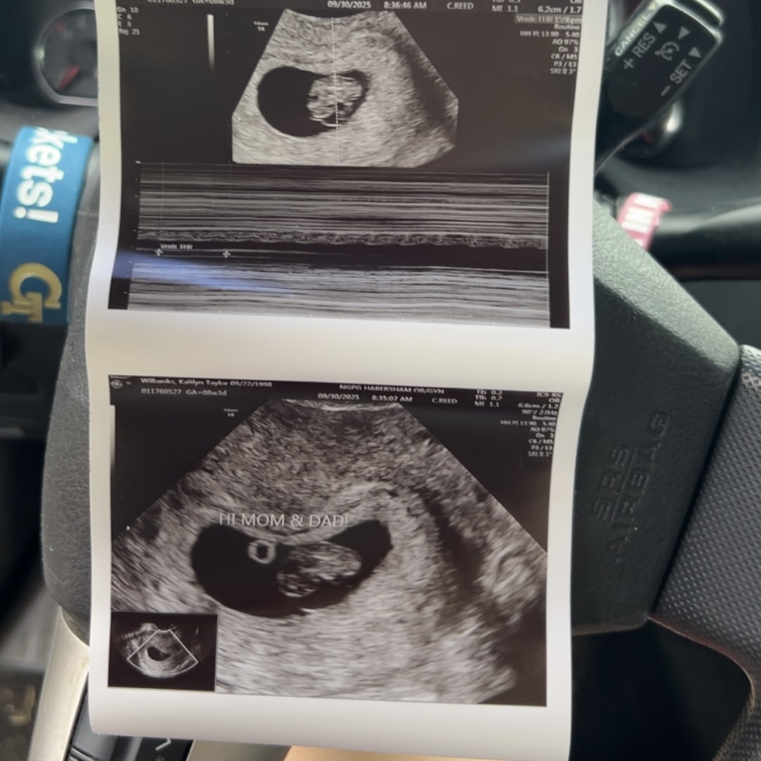 Photo shared by Katie for their Babylist baby registry.