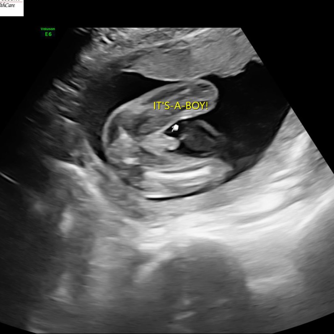 Photo shared by Johanna for their Babylist baby registry.