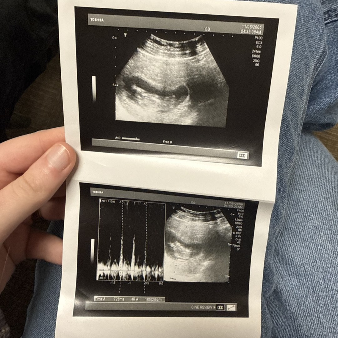 Photo shared by Ansleigh for their Babylist baby registry.