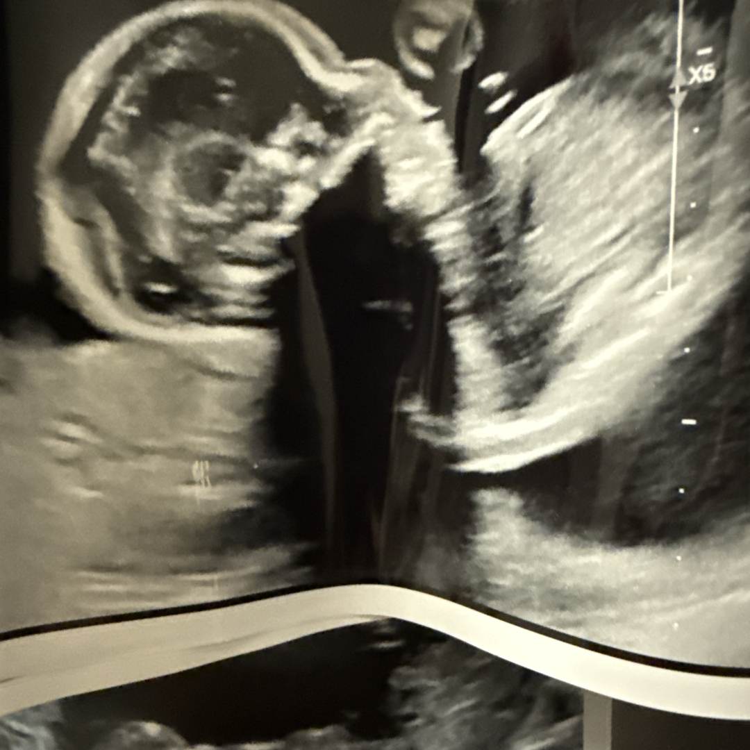 Photo shared by Elizabeth for their Babylist baby registry.