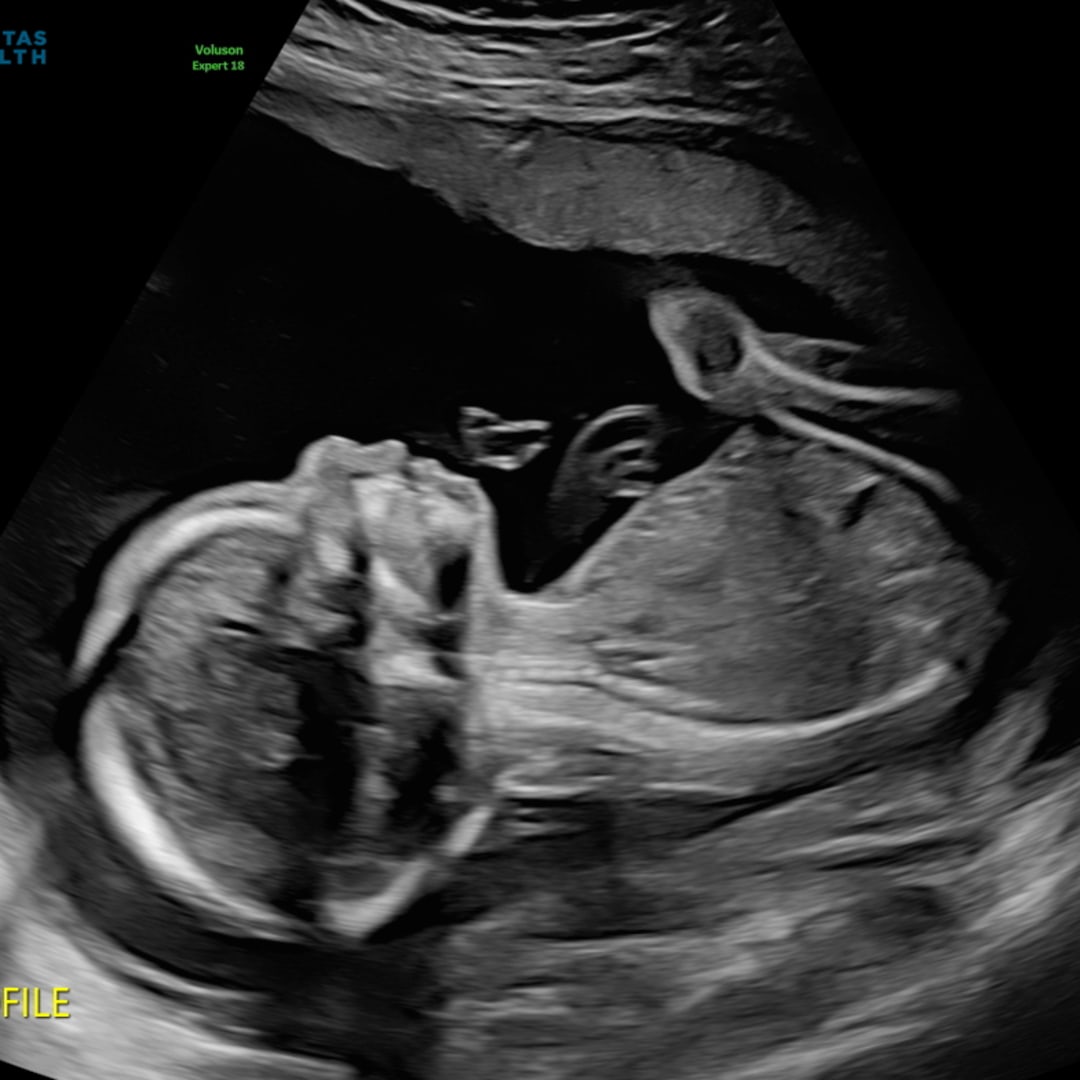 Photo shared by Jess for their Babylist baby registry.