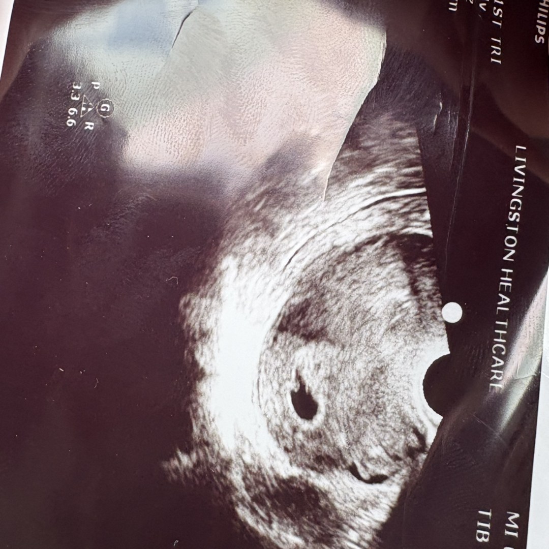 Photo shared by Riley for their Babylist baby registry.