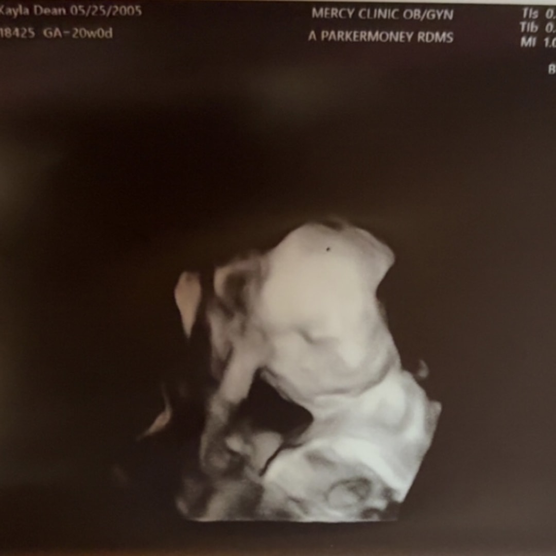 Photo shared by Kayla for their Babylist baby registry.