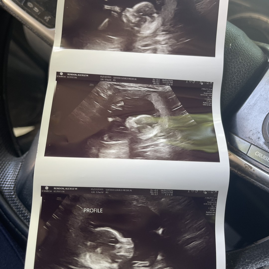 Photo shared by Alexuz for their Babylist baby registry.