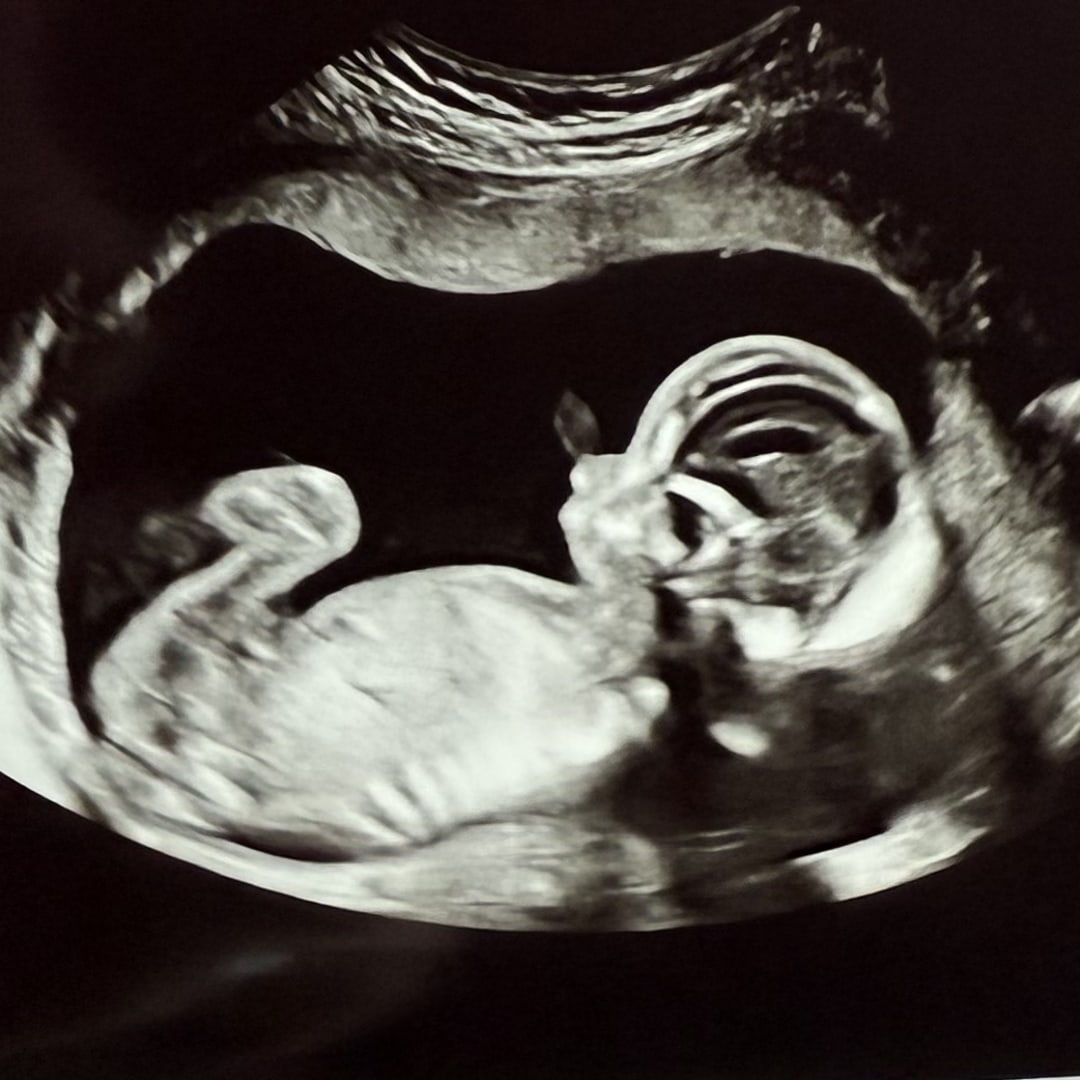 Photo shared by Jennifer for their Babylist baby registry.