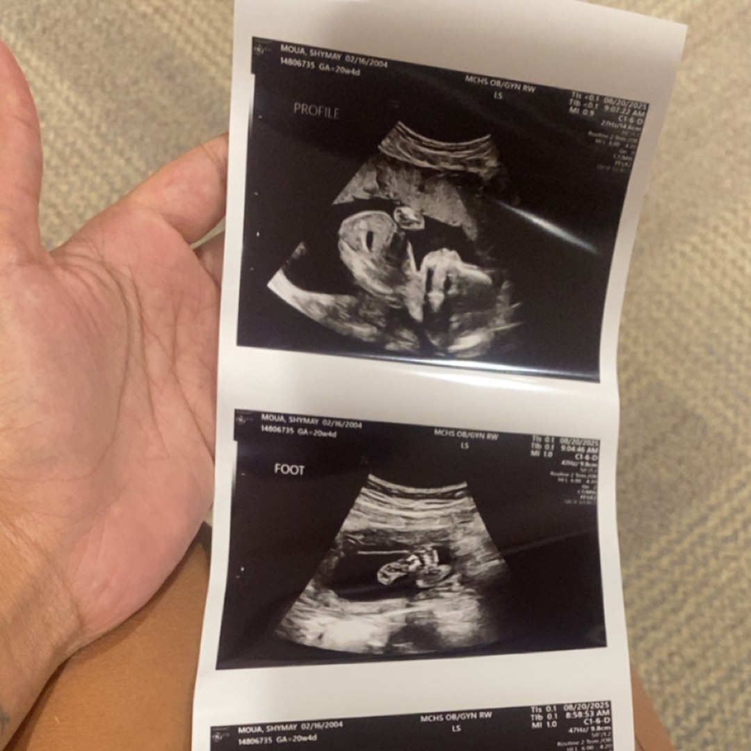 Photo shared by Shymay for their Babylist baby registry.