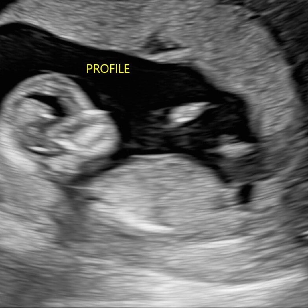 Photo shared by Catherine for their Babylist baby registry.