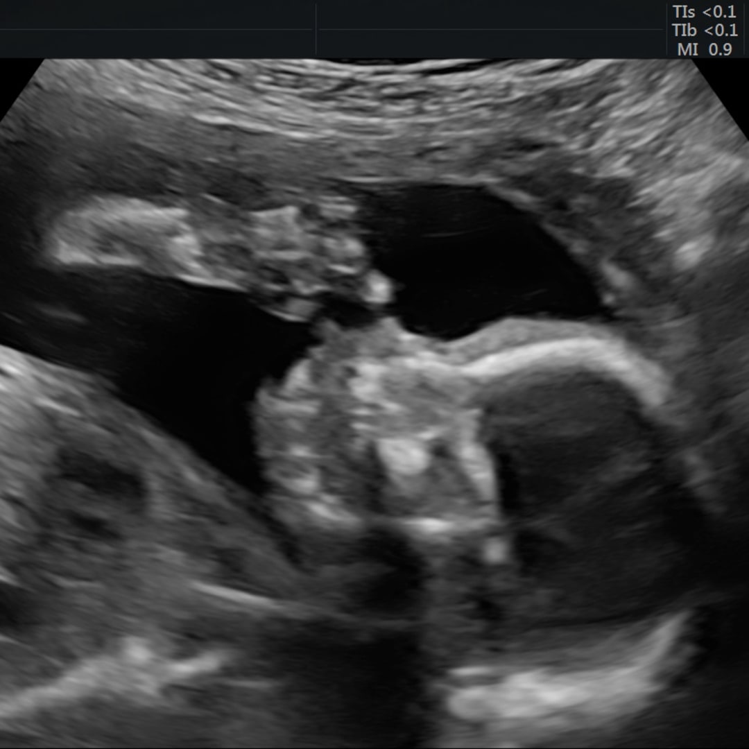 Photo shared by KJ for their Babylist baby registry.