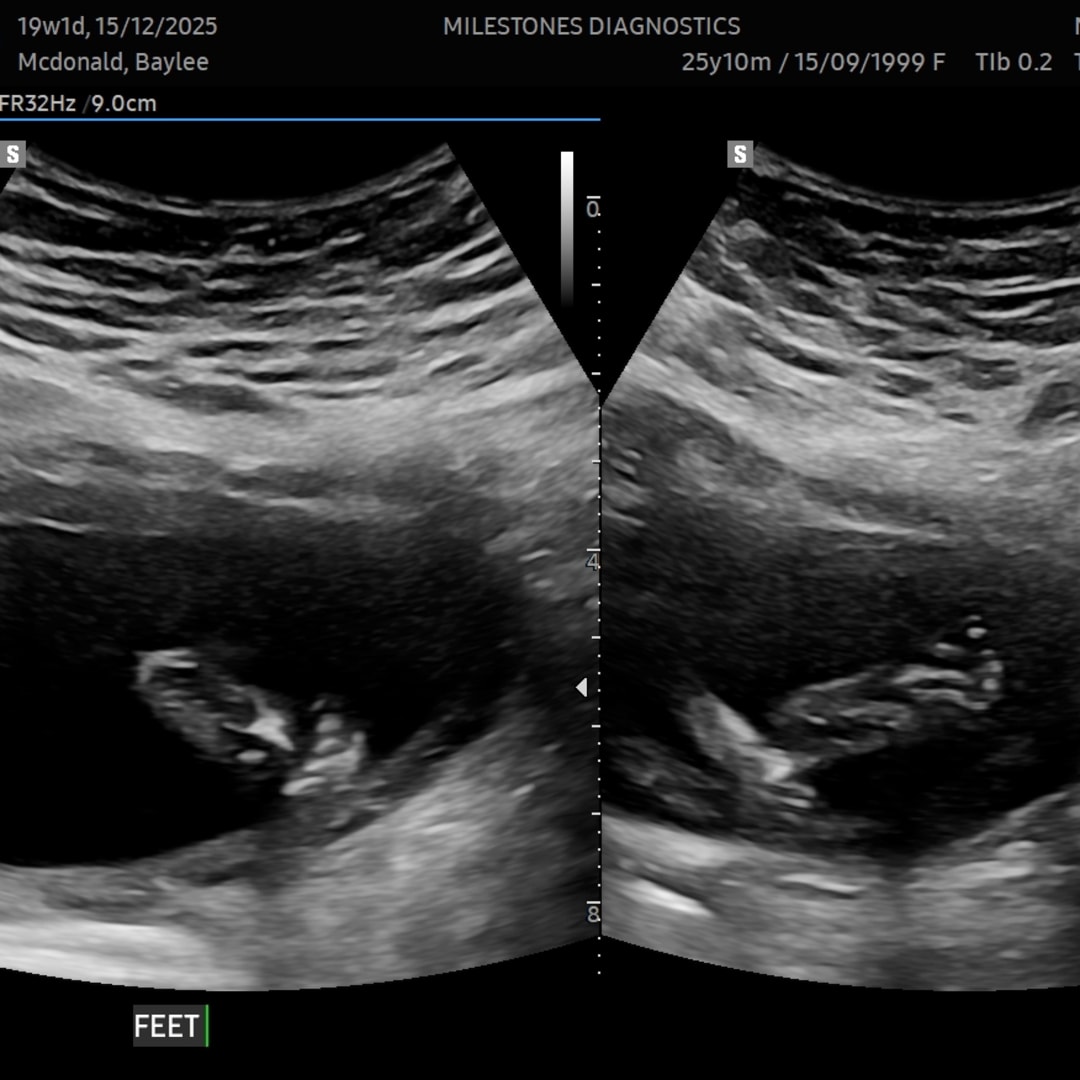 Photo shared by Baylee for their Babylist baby registry.