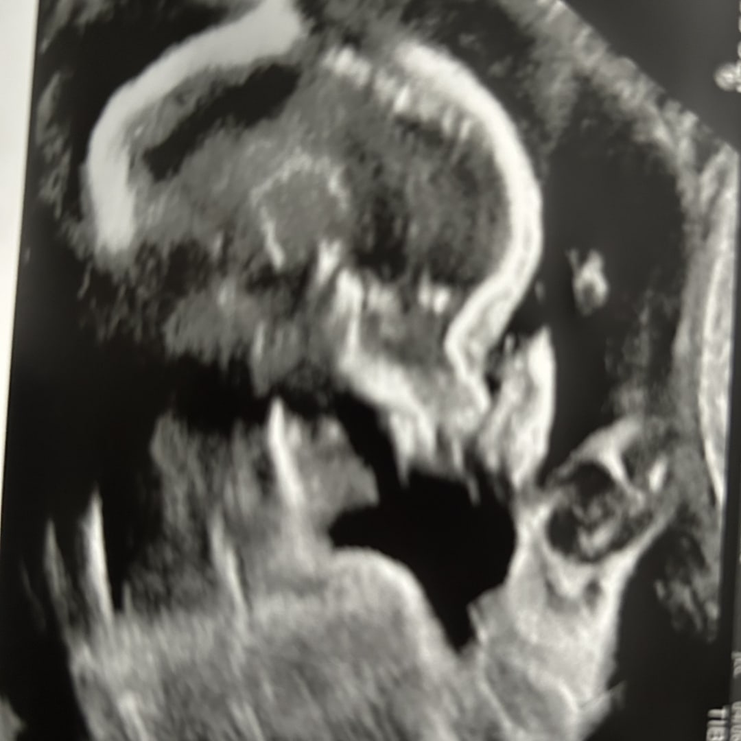 Photo shared by Jasmine for their Babylist baby registry.