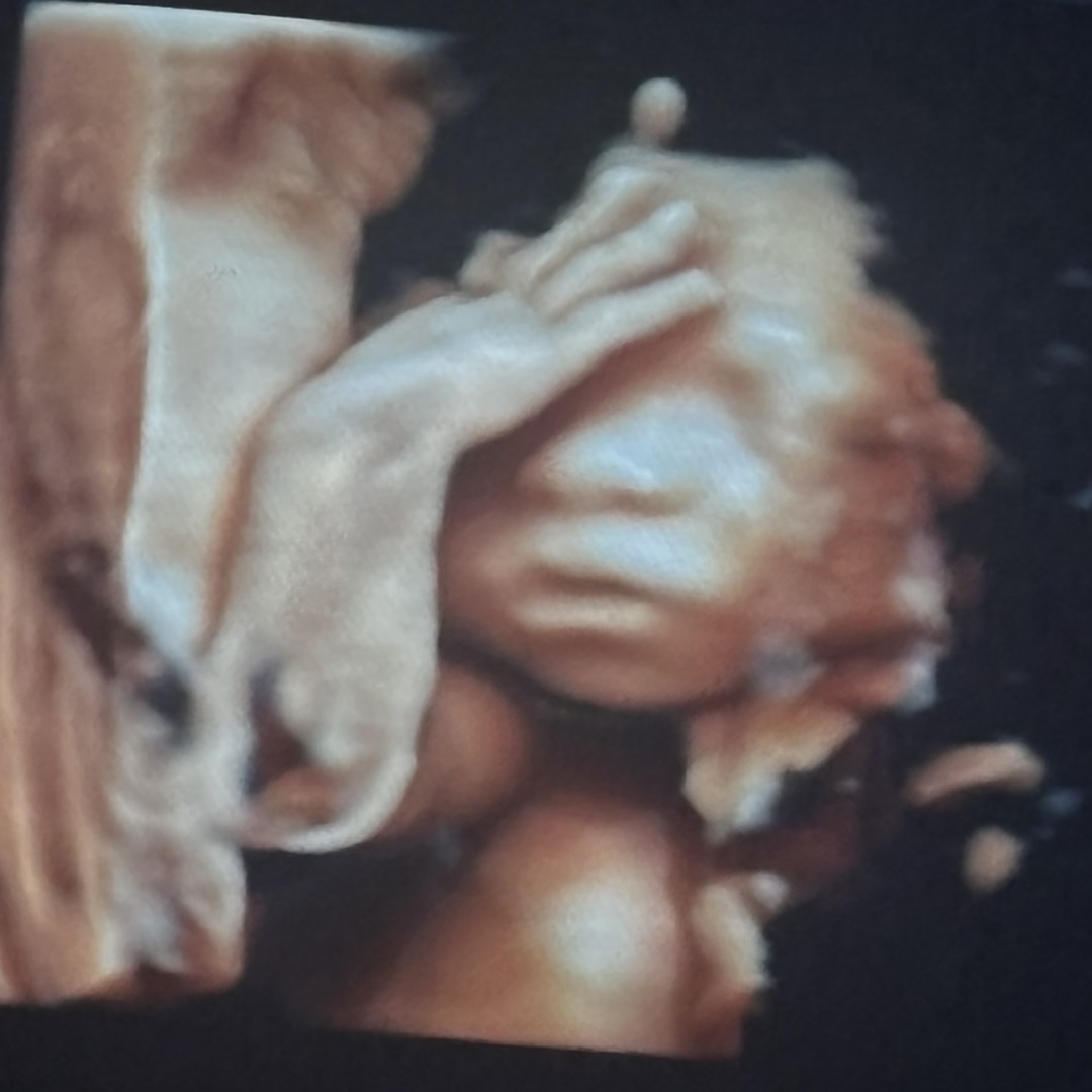 Photo shared by Cassie for their Babylist baby registry.