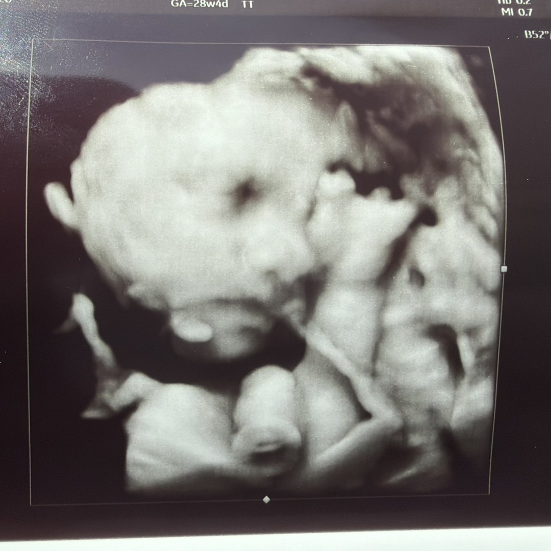 Photo shared by Sandy for their Babylist baby registry.