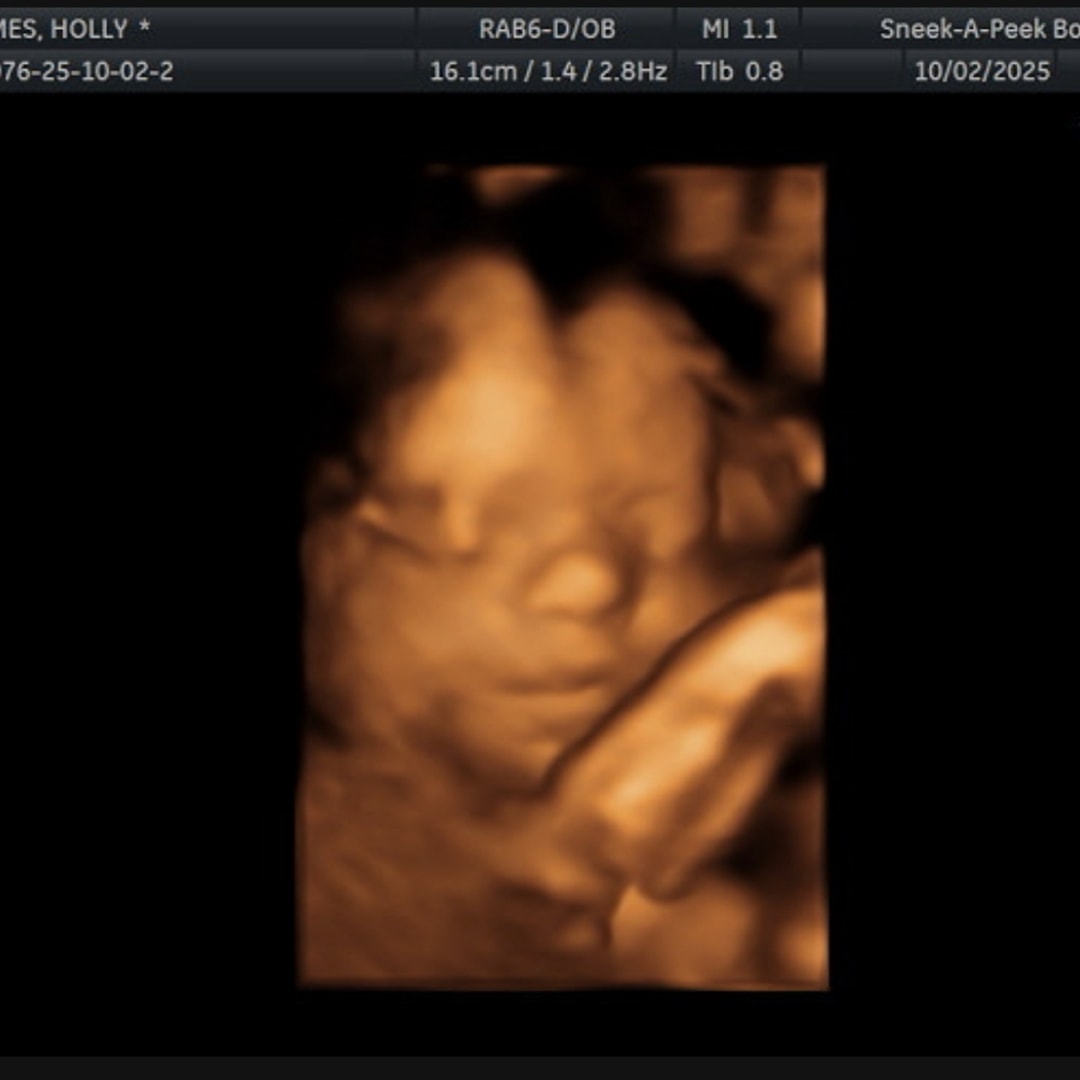 Photo shared by Holly for their Babylist baby registry.