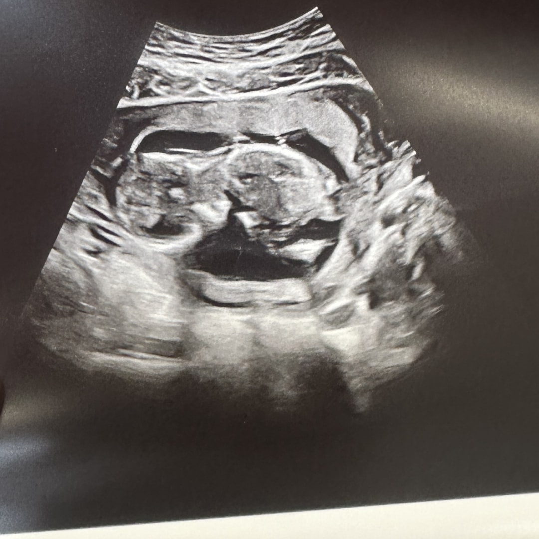 Photo shared by Tyesha for their Babylist baby registry.