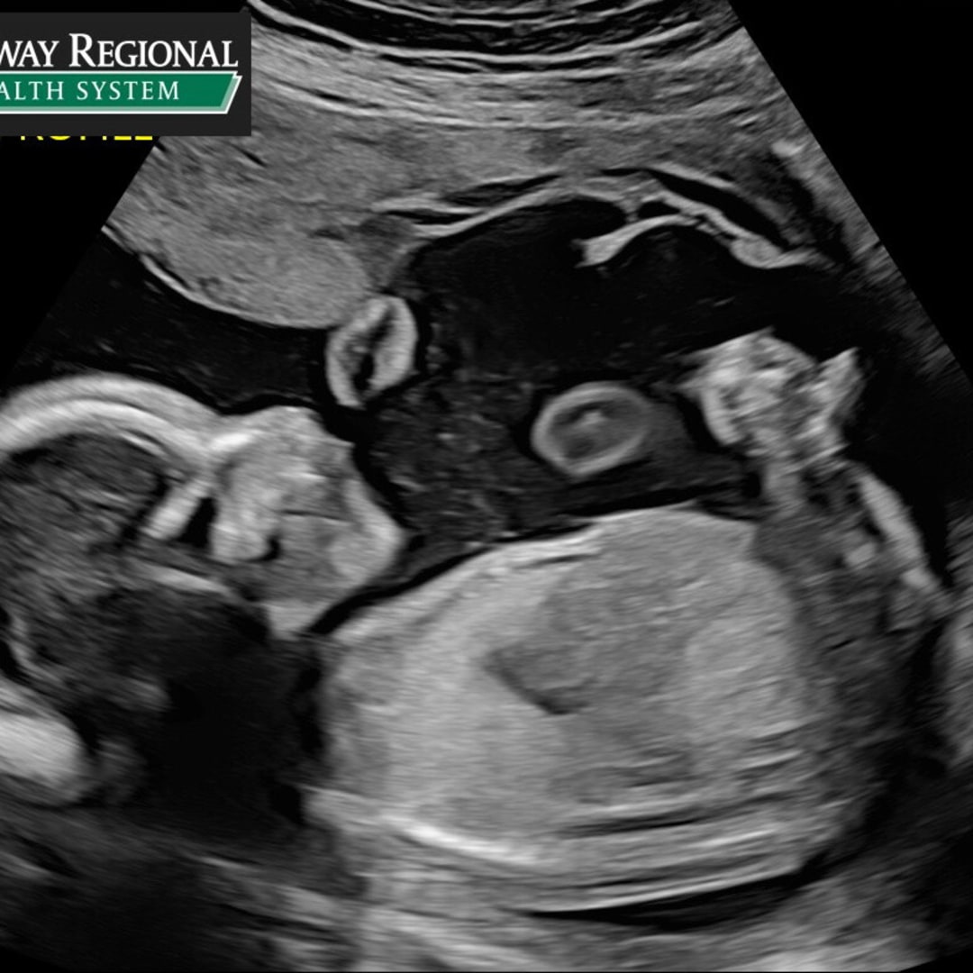 Photo shared by Ambar for their Babylist baby registry.