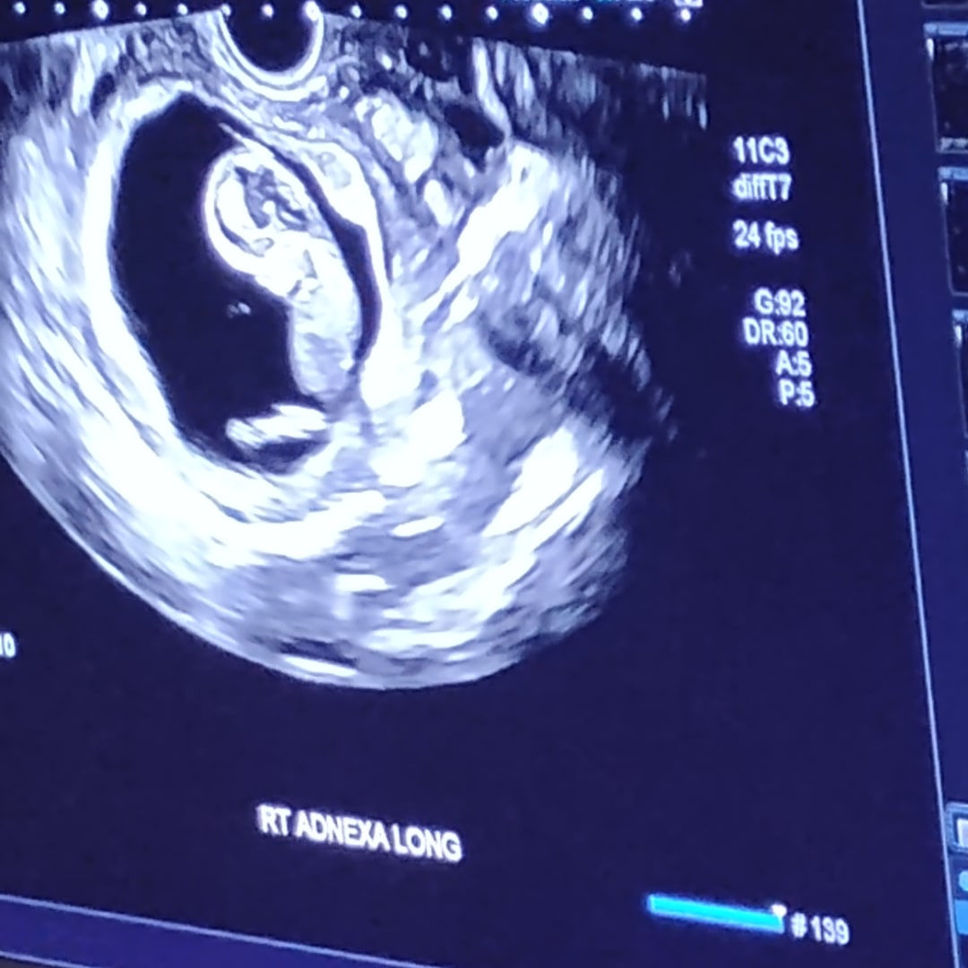 Photo shared by Bobbie for their Babylist baby registry.