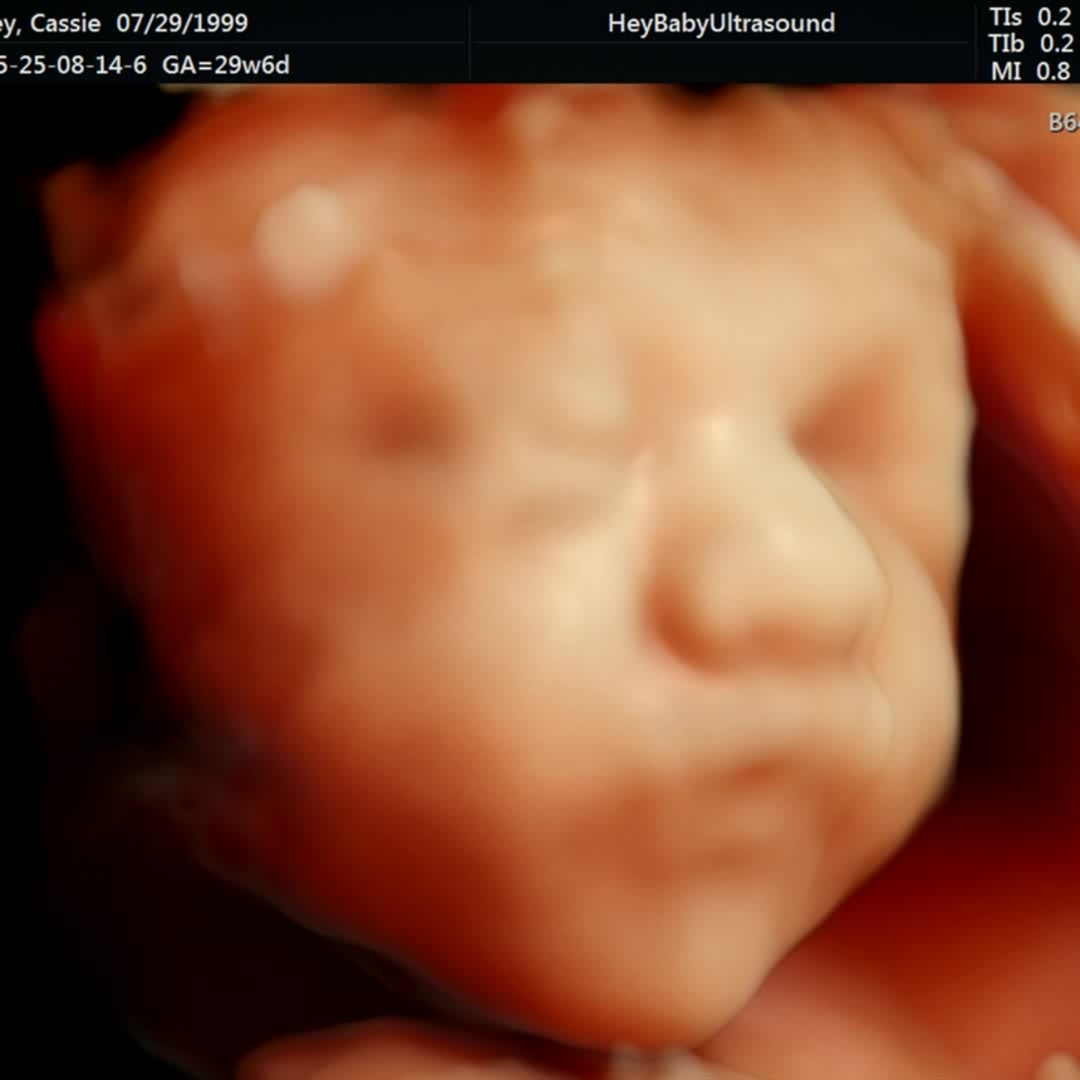 Photo shared by Cassandra for their Babylist baby registry.