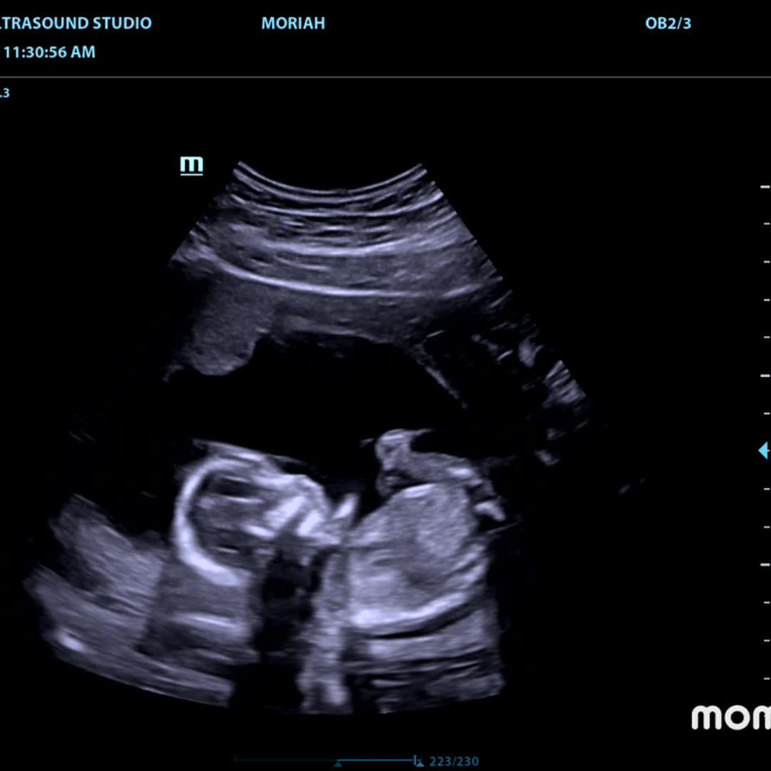 Photo shared by Moriah for their Babylist baby registry.