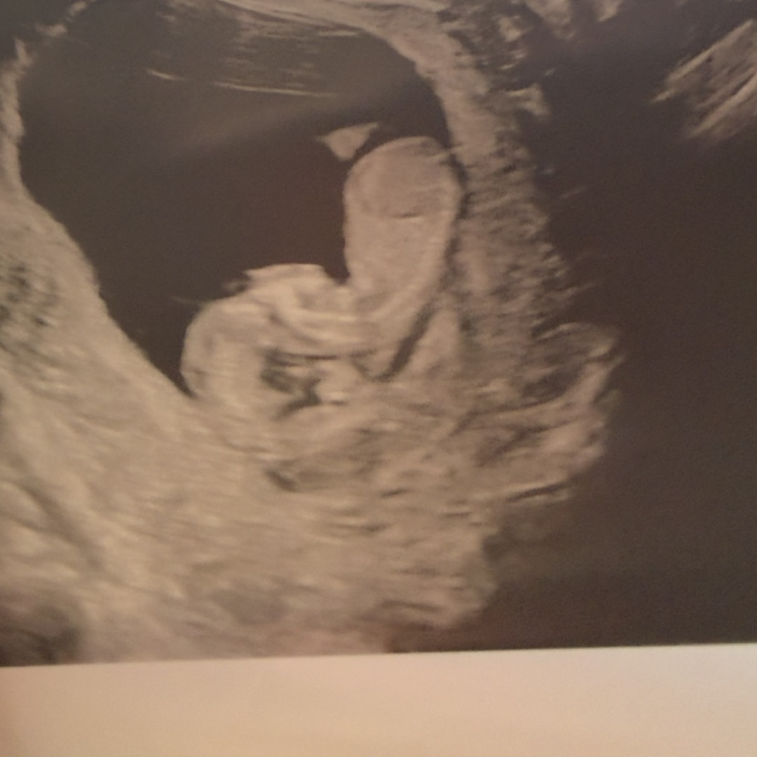 Photo shared by Elizabeth for their Babylist baby registry.