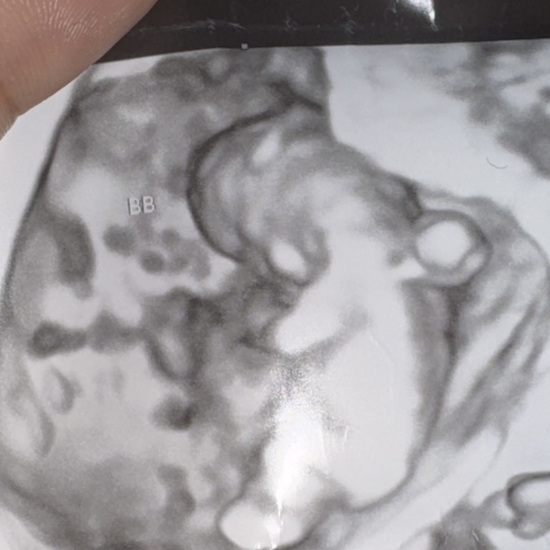 Photo shared by Glenys for their Babylist baby registry.