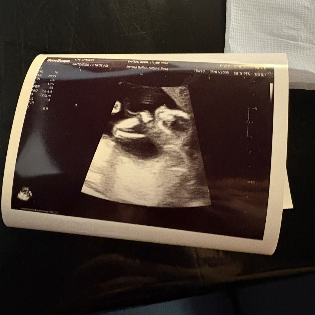 Photo shared by Haylie for their Babylist baby registry.