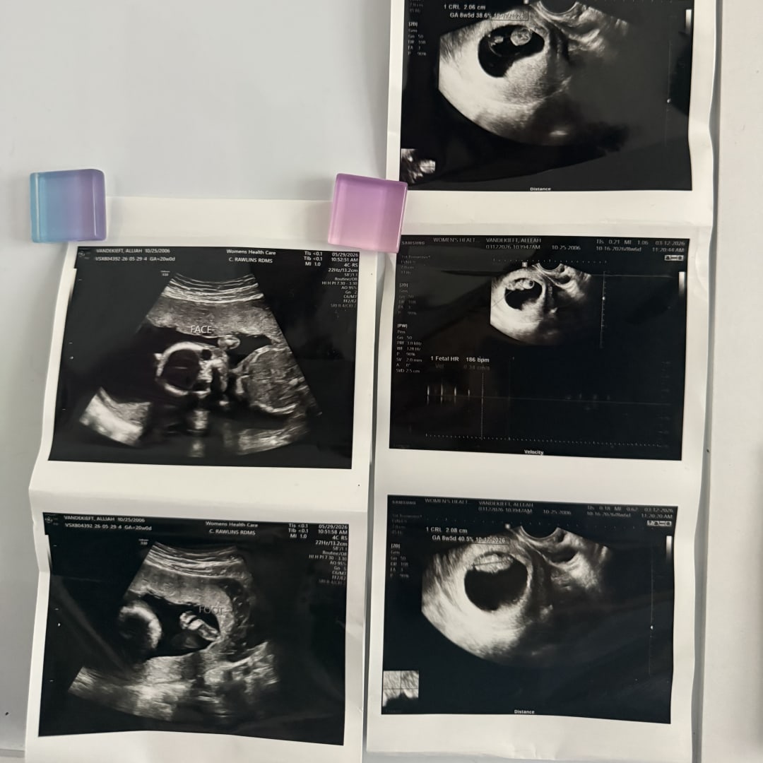 Photo shared by Alleah for their Babylist baby registry.