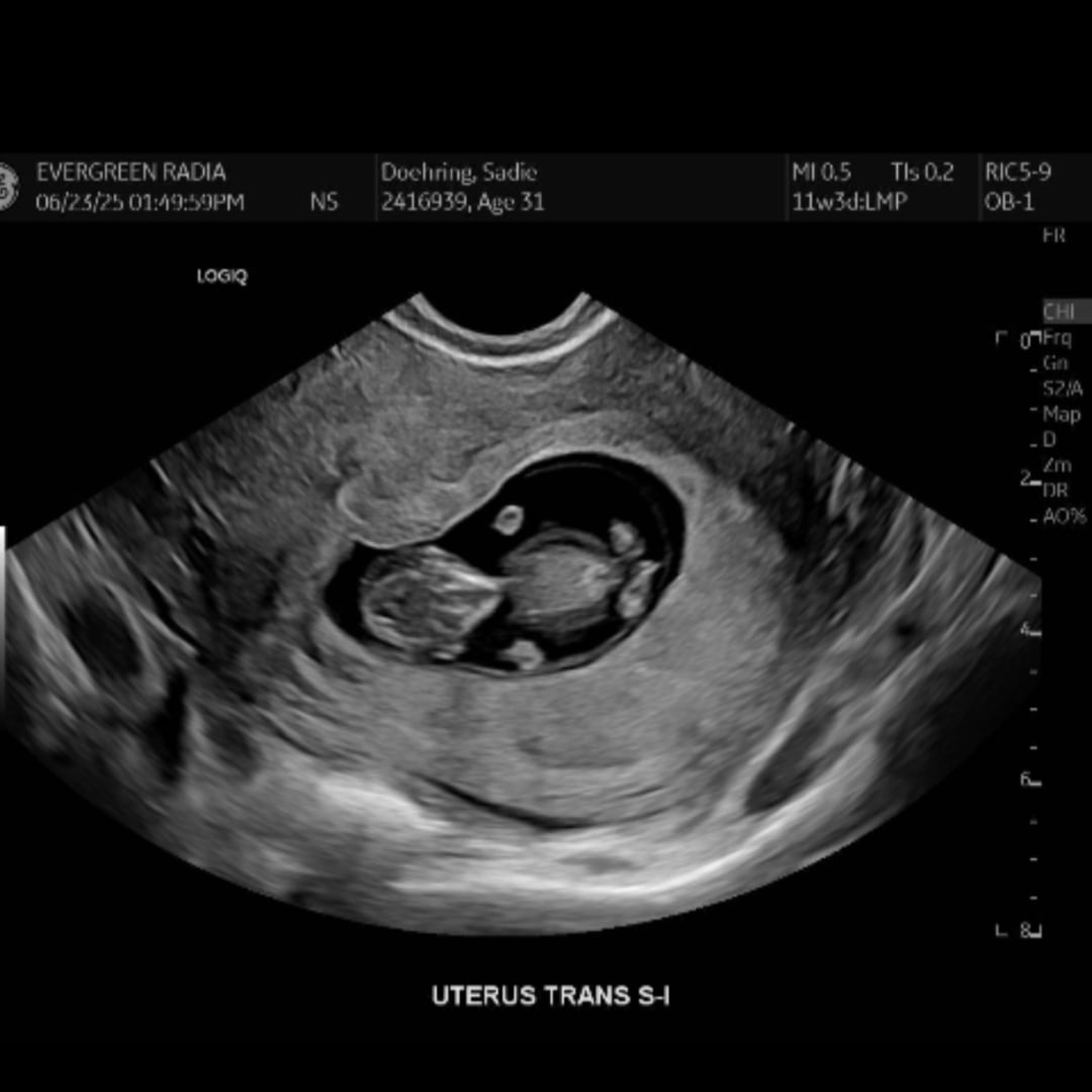 Photo shared by Sadie for their Babylist baby registry.