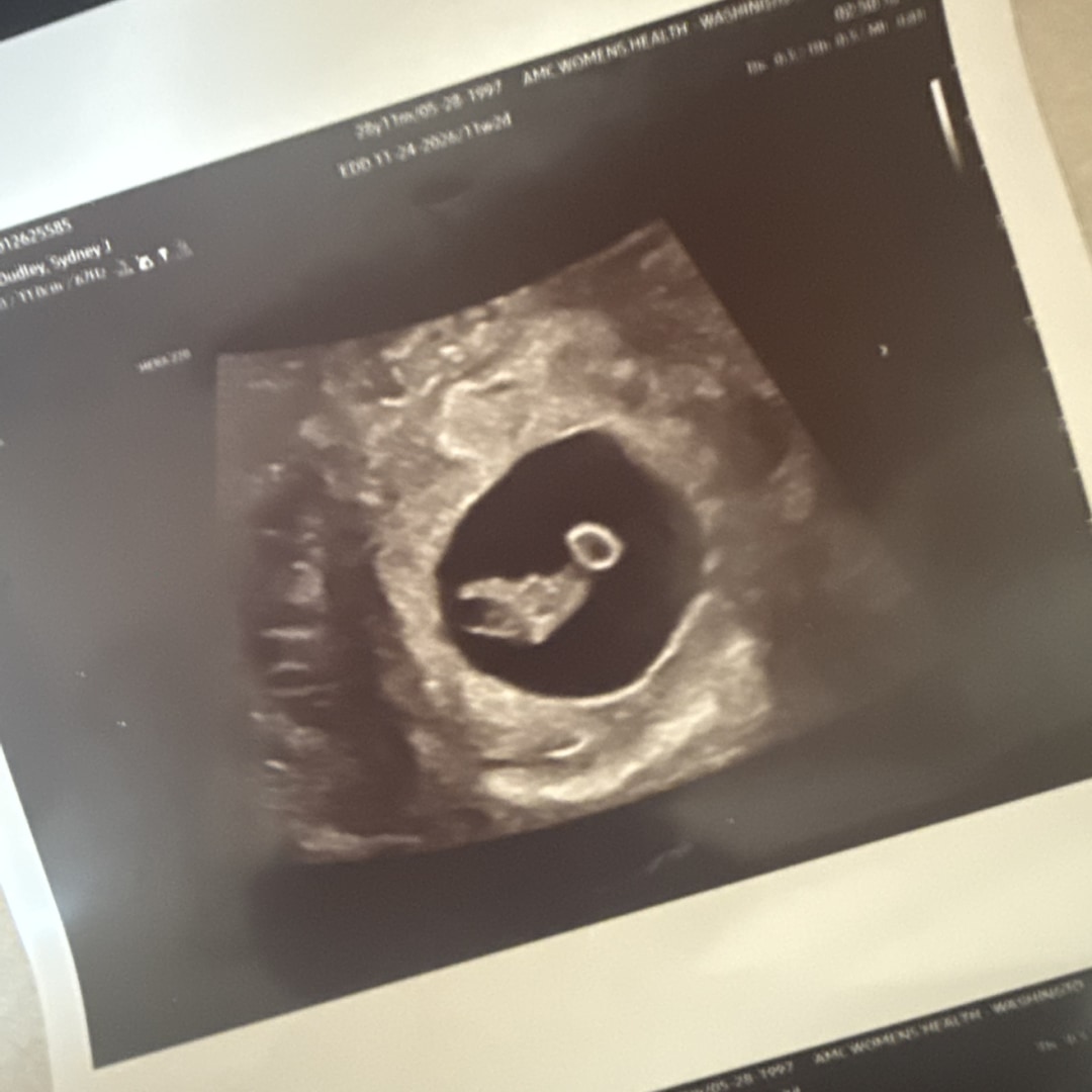 Photo shared by Sydney for their Babylist baby registry.