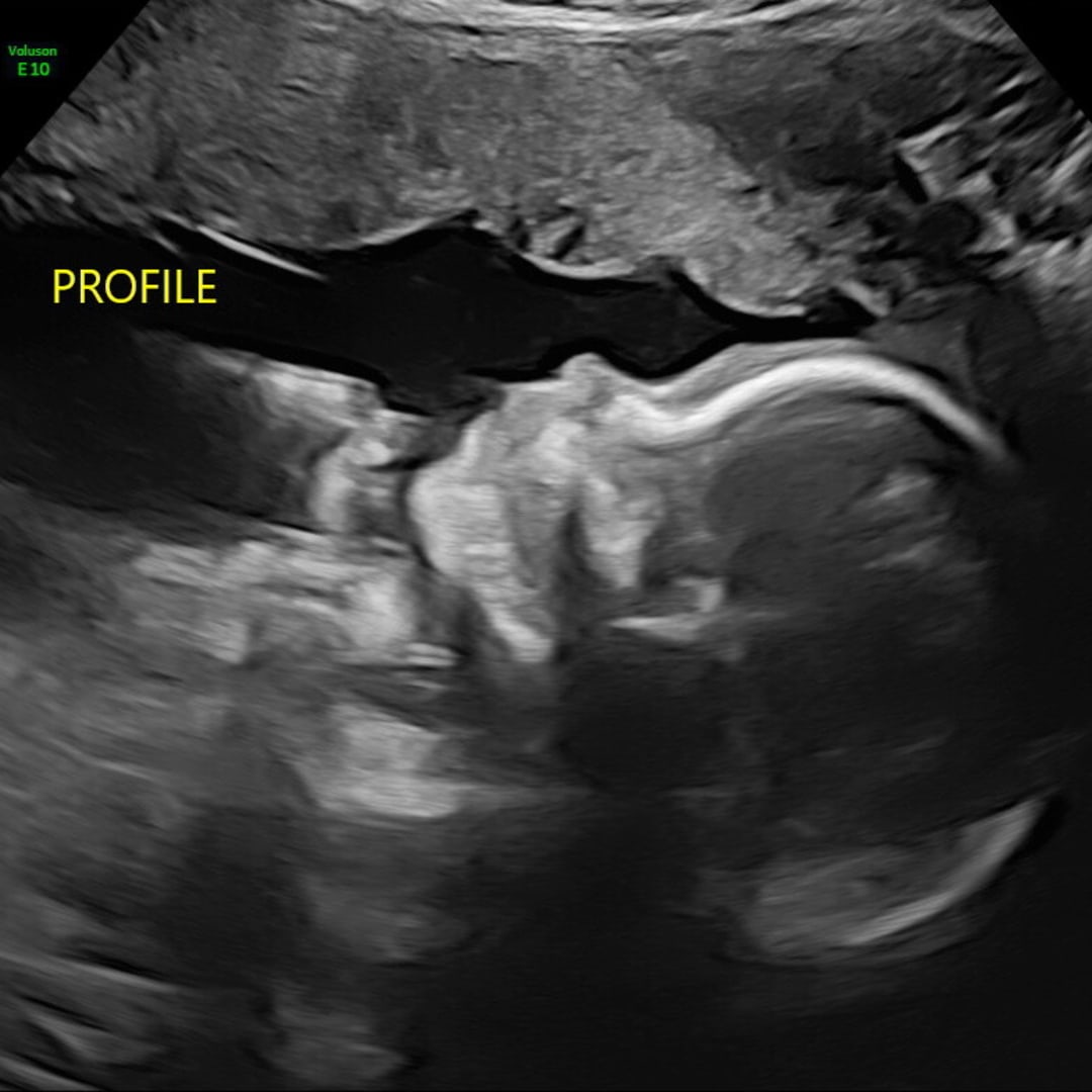 Photo shared by Addie for their Babylist baby registry.