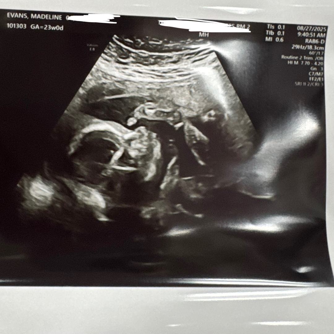 Photo shared by Madeline for their Babylist baby registry.