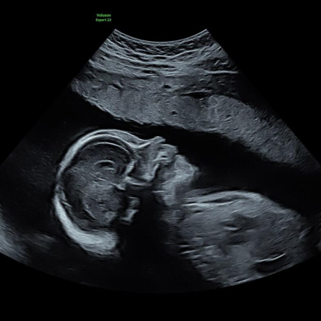 Photo shared by Daniela for their Babylist baby registry.