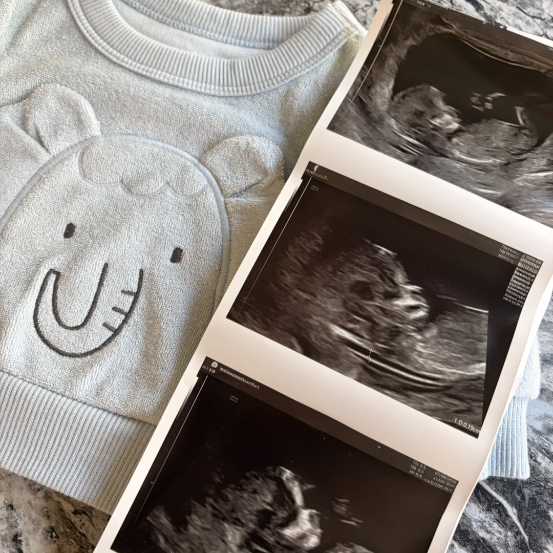 Photo shared by Samantha for their Babylist baby registry.