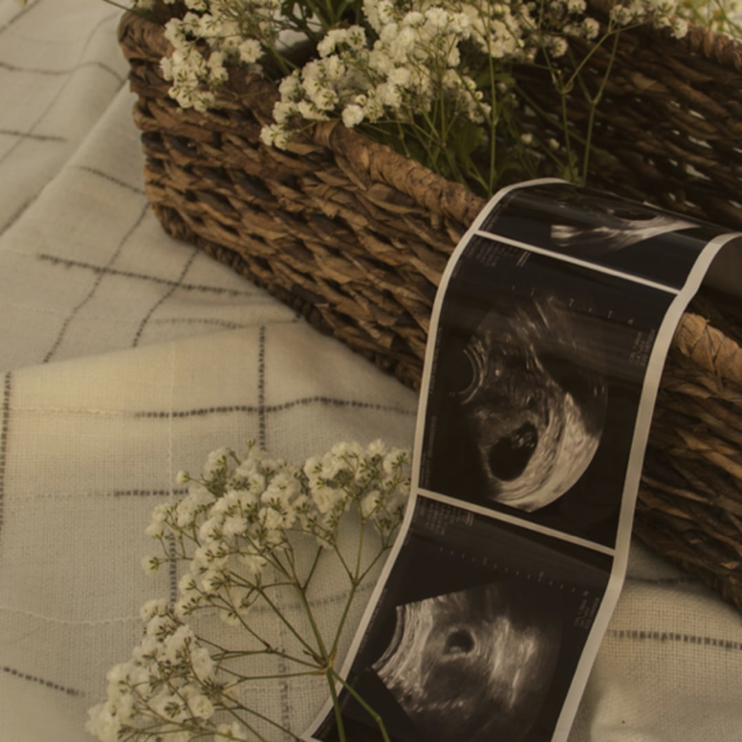 Photo shared by Skylie for their Babylist baby registry.