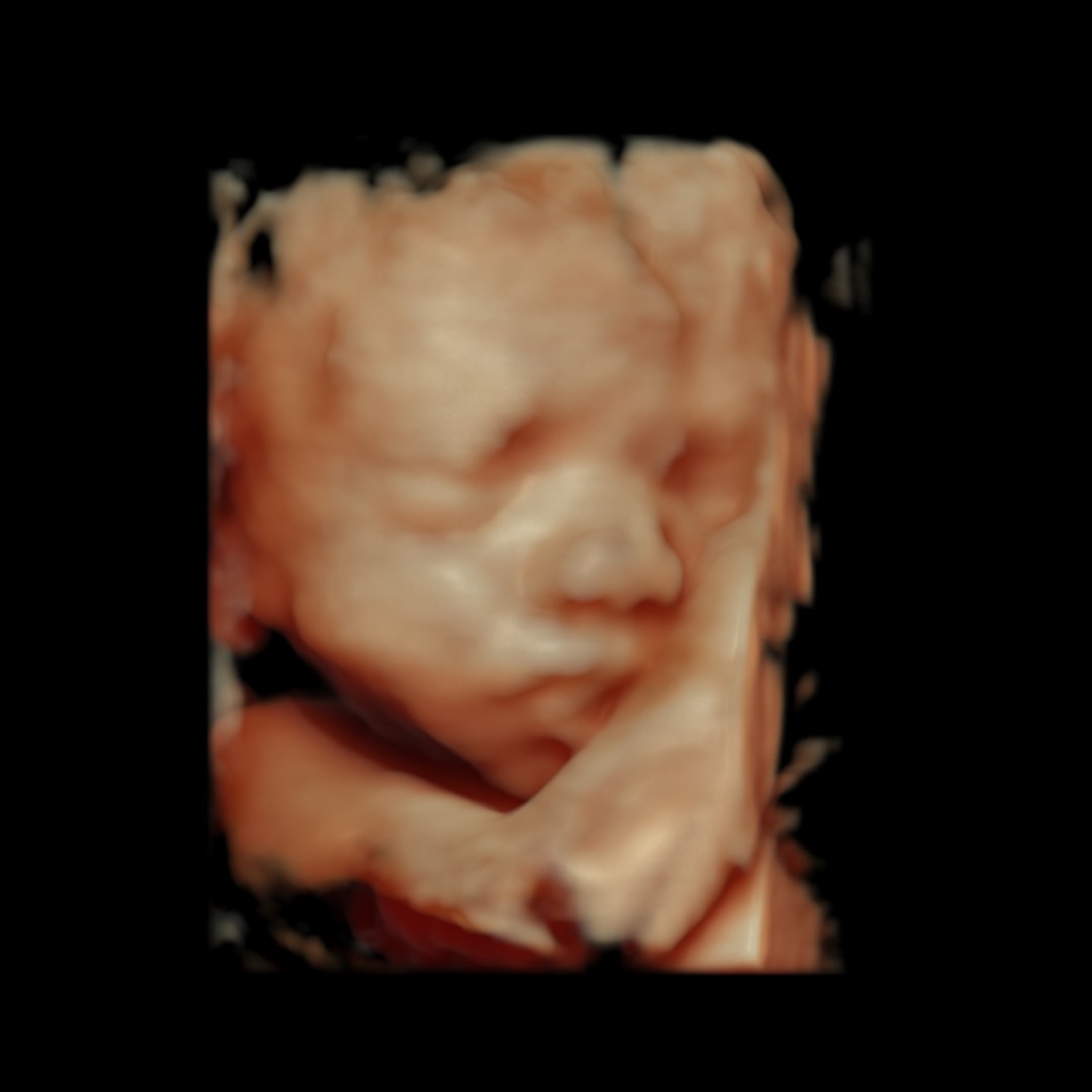 Photo shared by Amanda for their Babylist baby registry.