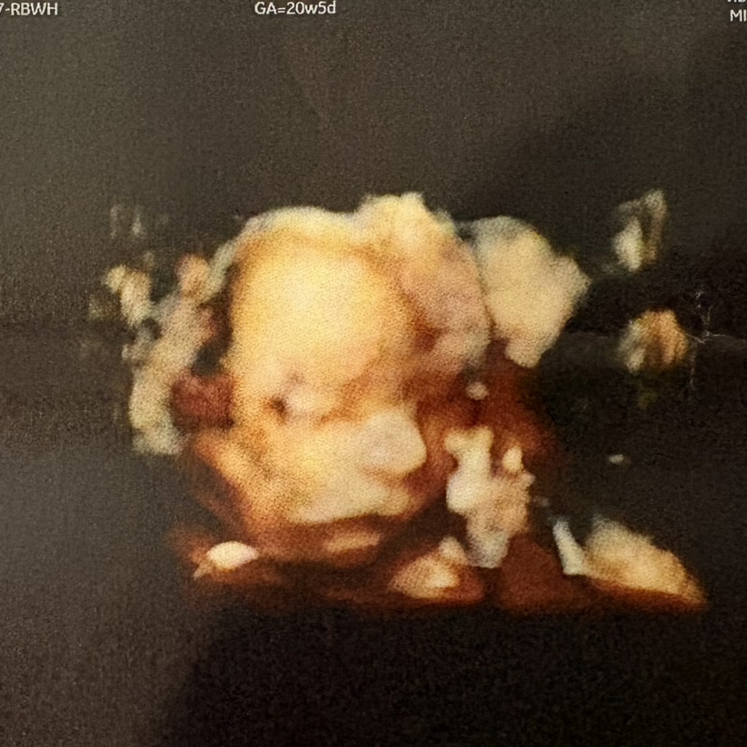 Photo shared by Skye for their Babylist baby registry.