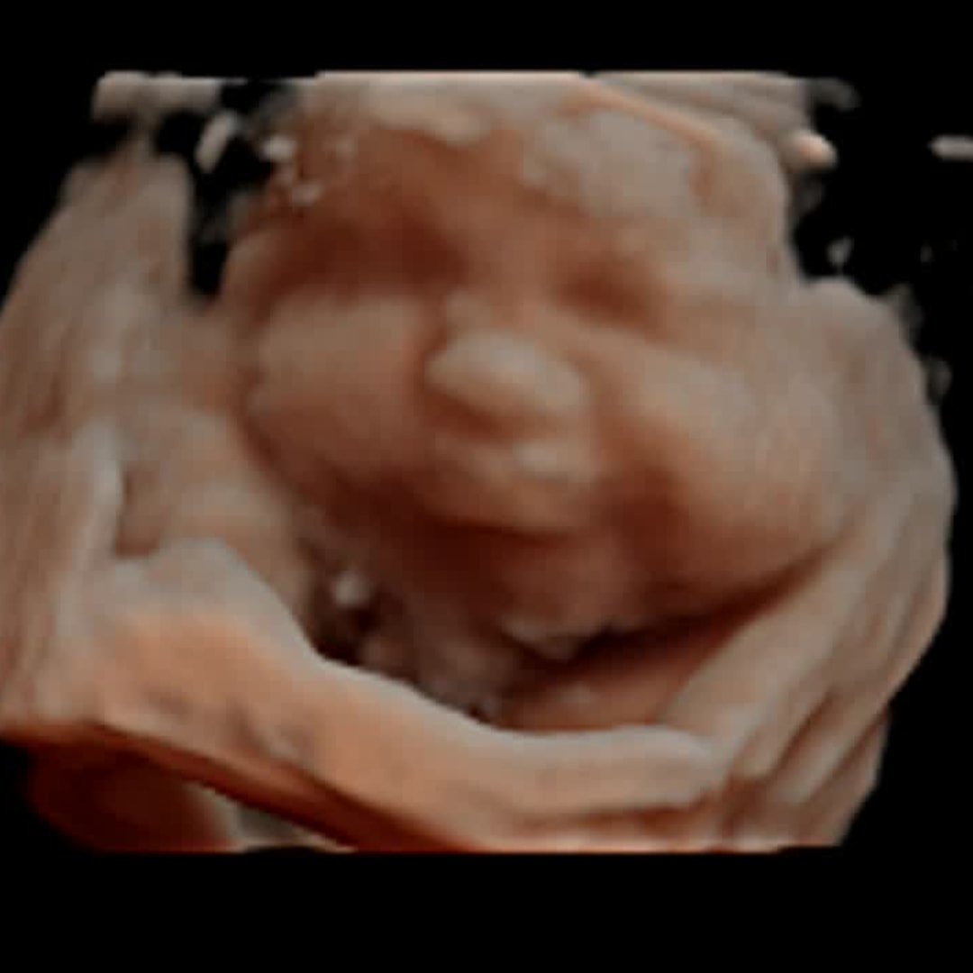 Photo shared by Emily for their Babylist baby registry.