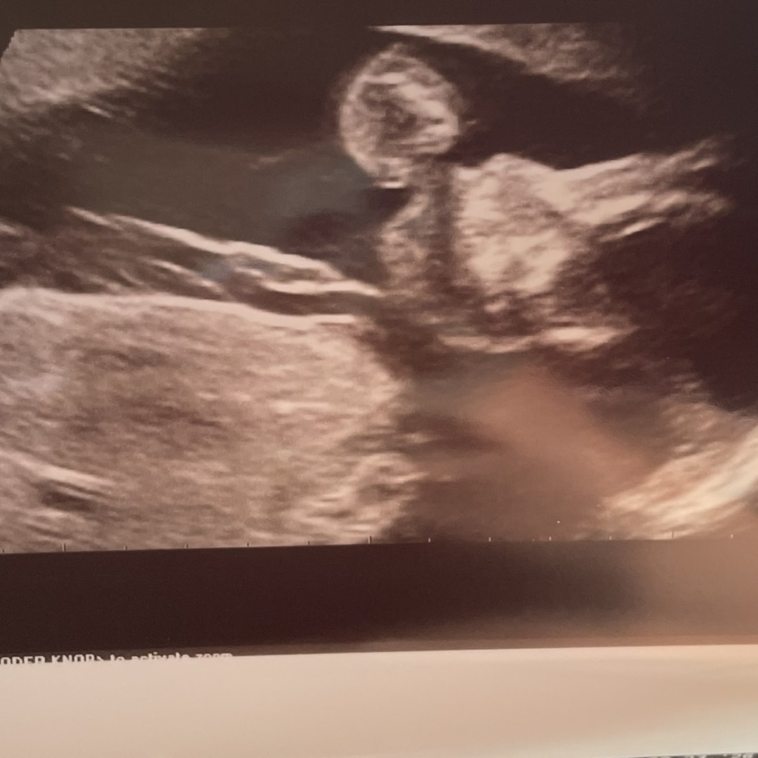 Photo shared by Angela for their Babylist baby registry.