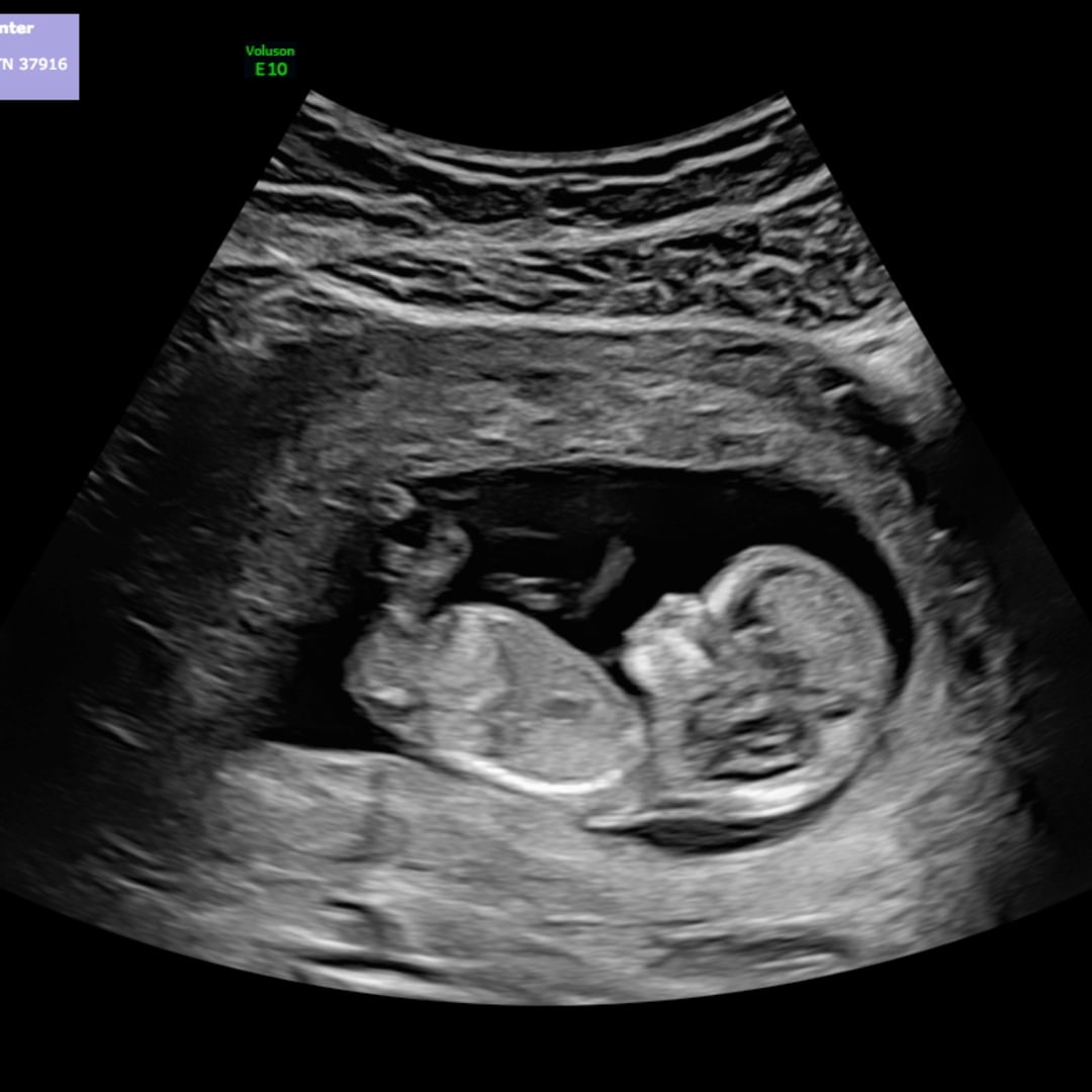 Photo shared by Sarah for their Babylist baby registry.