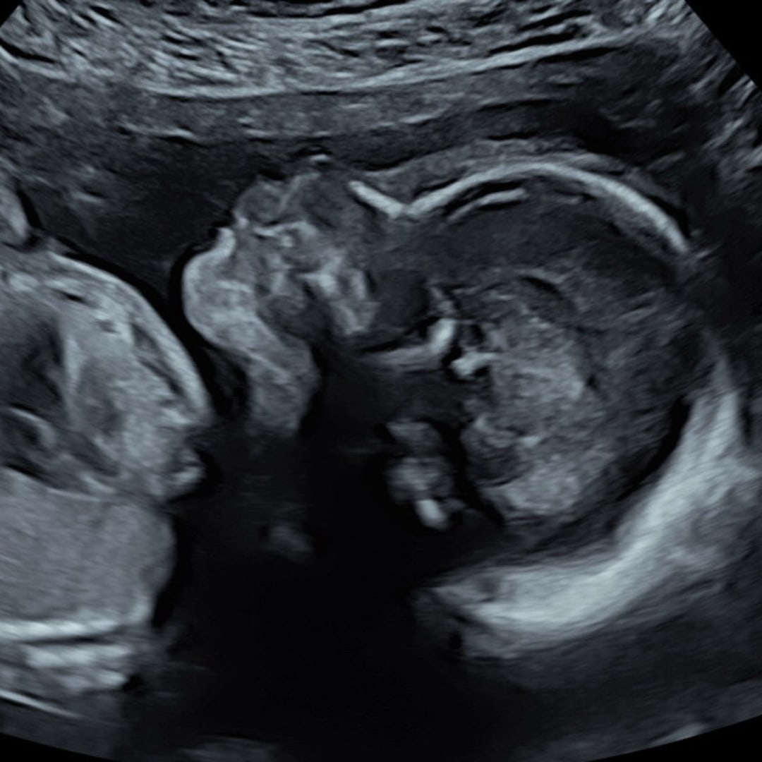 Photo shared by Kimberly for their Babylist baby registry.