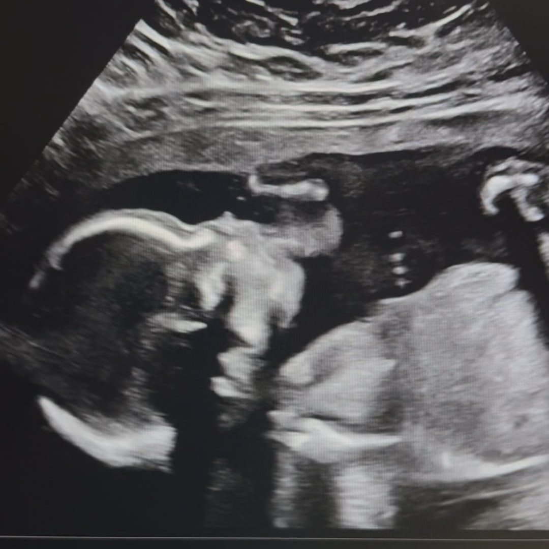 Photo shared by Jenna for their Babylist baby registry.