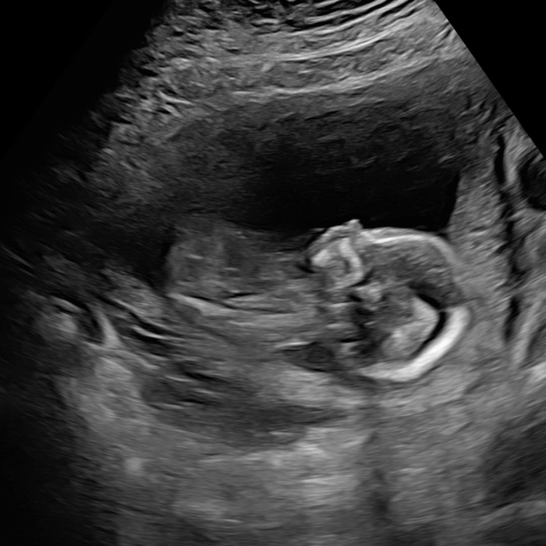 Photo shared by Bethany for their Babylist baby registry.