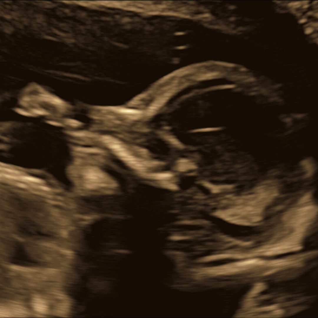 Photo shared by Lauren for their Babylist baby registry.
