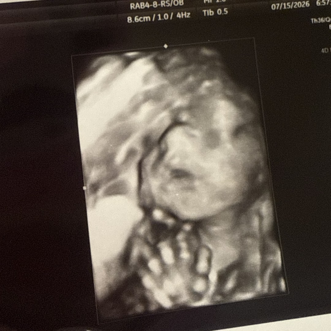 Photo shared by Jayle for their Babylist baby registry.