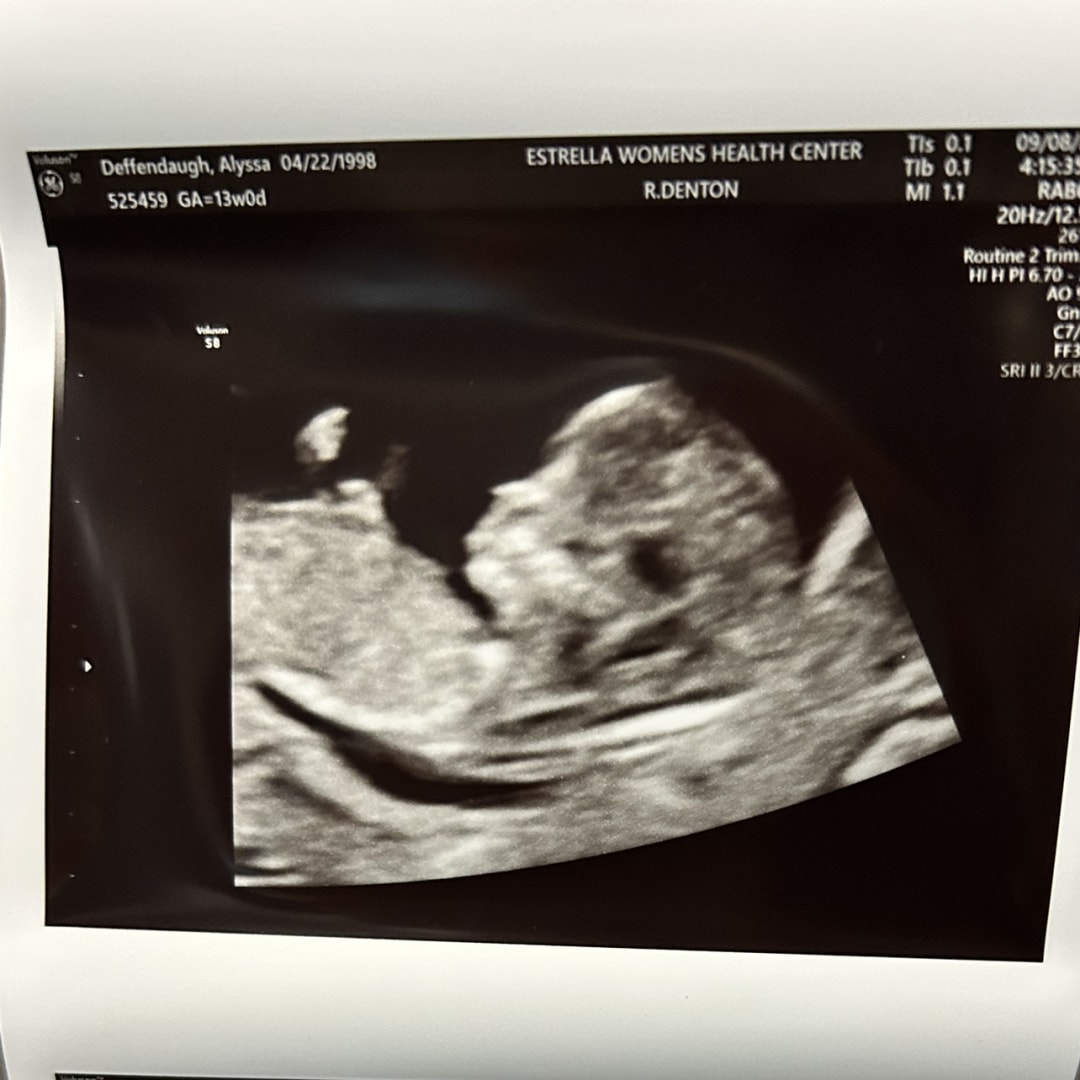 Photo shared by Alyssa for their Babylist baby registry.