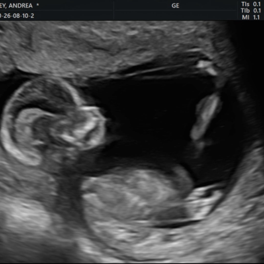 Photo shared by Andrea for their Babylist baby registry.