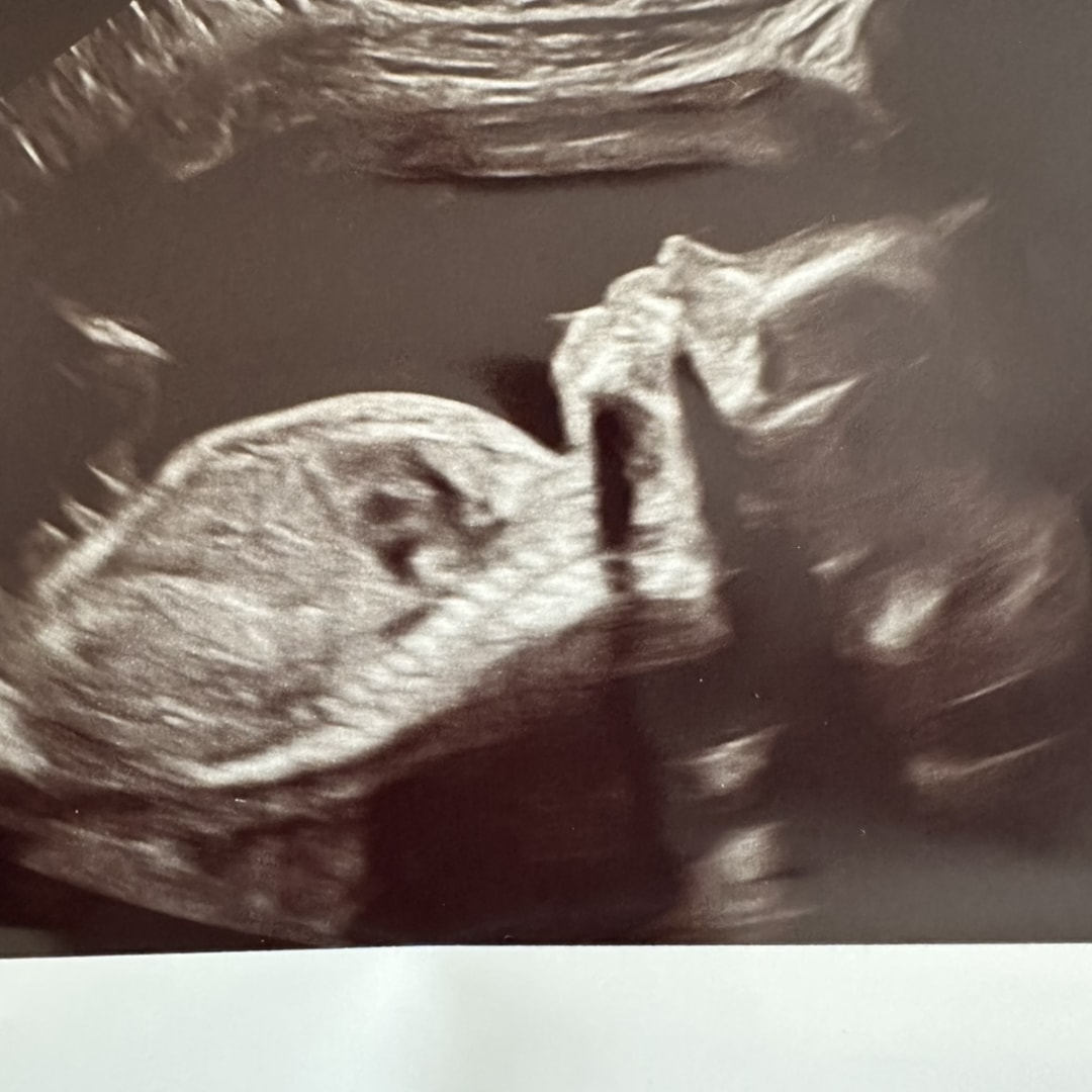 Photo shared by Allison for their Babylist baby registry.